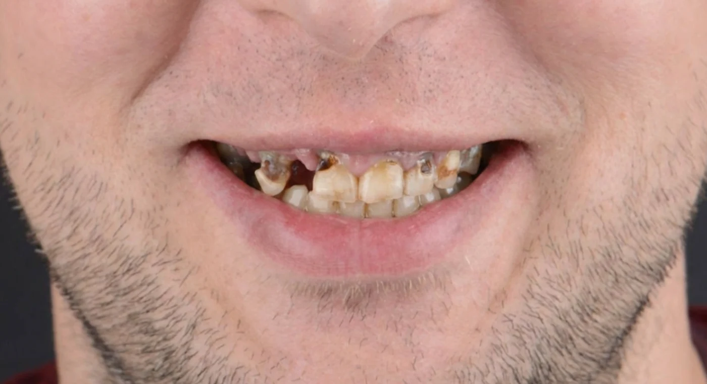 image before