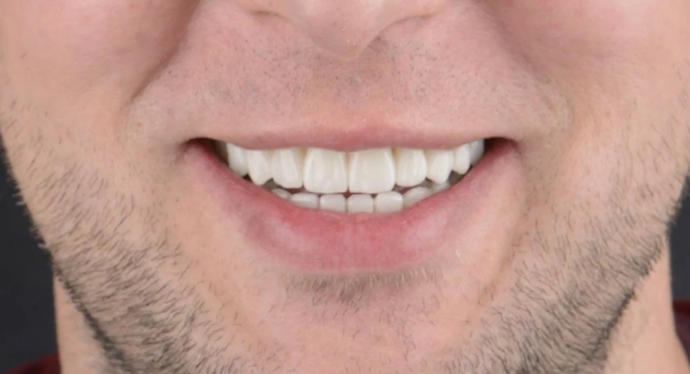 image after
