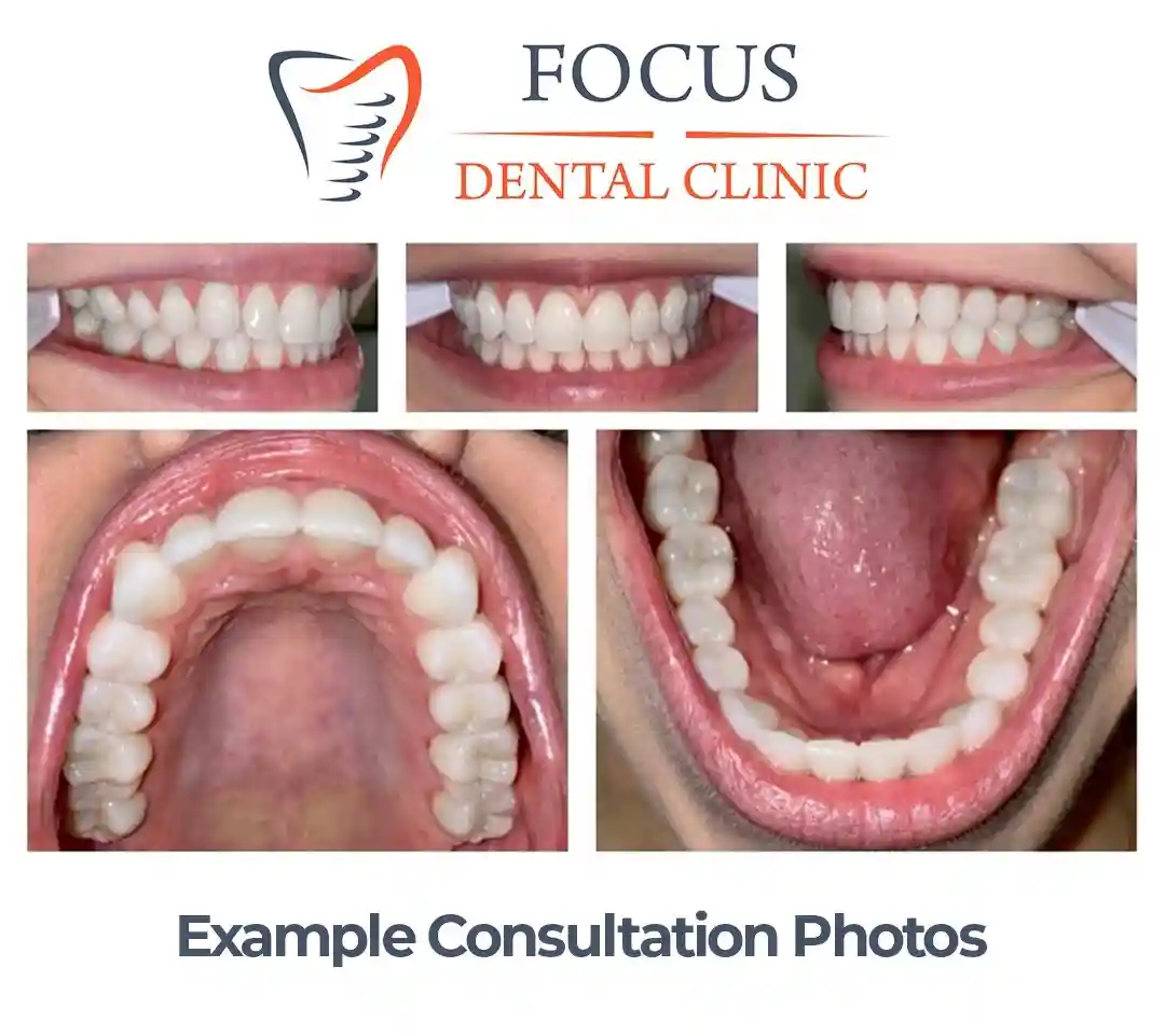 Example consultation dental photos