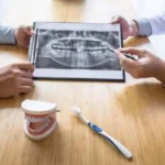 dental implants