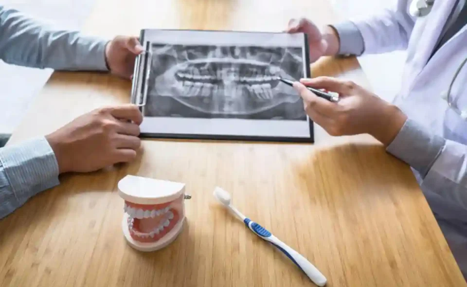 dental implants