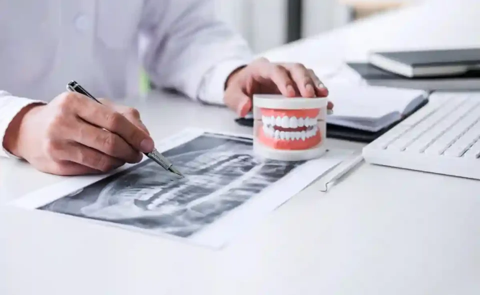 dental implants