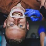 Dental Implants Turkey: Step-by-Step Process for UK Patients