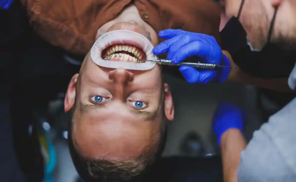 Dental Implants Turkey: Step-by-Step Process for UK Patients