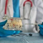 Implant Brands in Turkey