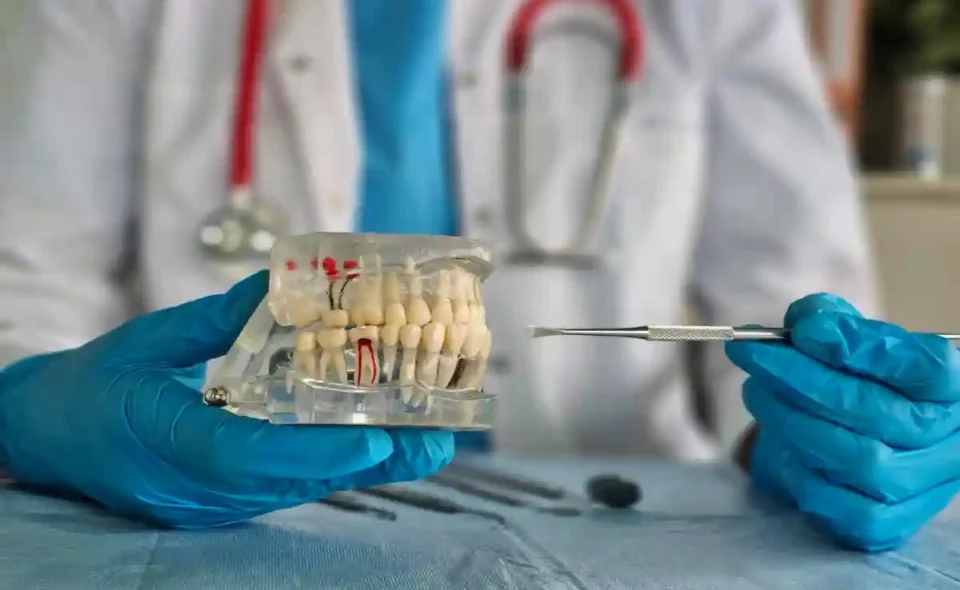 Implant Brands in Turkey