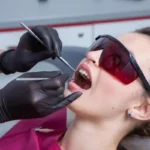 laser teeth