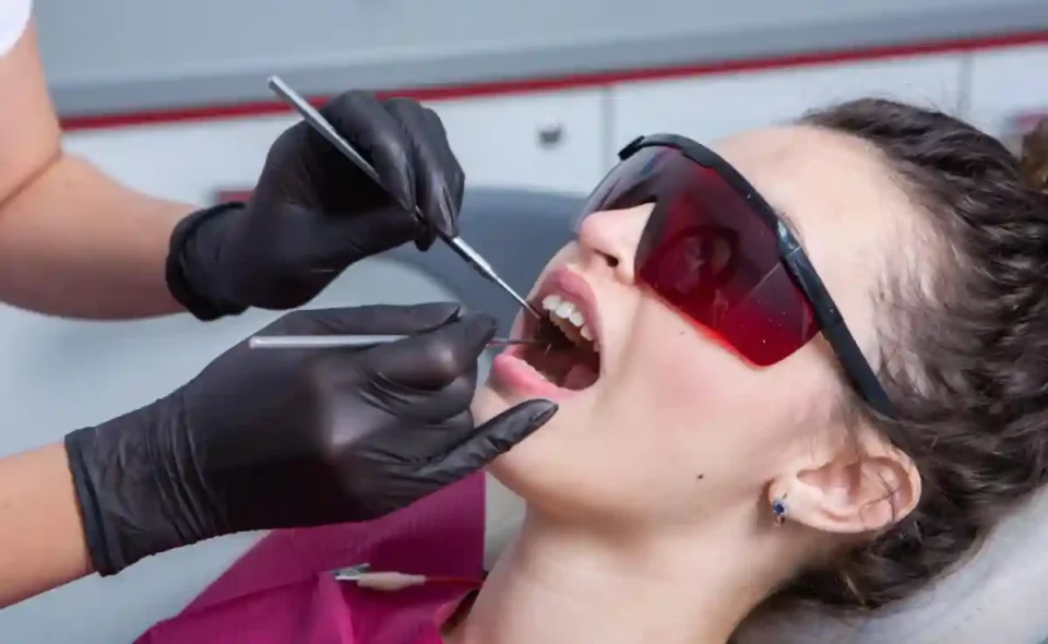 laser teeth